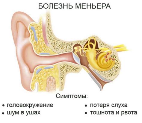 Причины и лечение закладывания ушей из-за давления